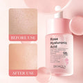 Hyaluronic Acid Facial Moisturizing Improving Dry Skin